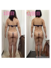 リオンズ 茨城ミスターマックス取手店/セルバーン付き痩身12回４０代