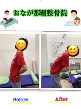 おなが浦添当山整体院/腰痛、可動域改善！