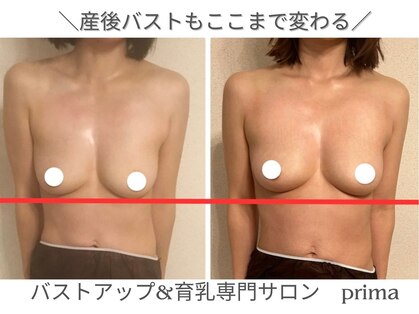プリマ(prima)の写真