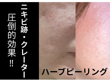 フィーゴ 天満店(FiGO)の写真