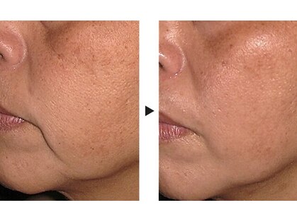 プリマプリート 島店の写真