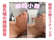 リリー(LILY)/韓国で大人気！