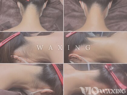 ヴィオワクシング(VIO WAXING)の写真