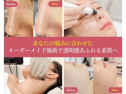 ハーボプラス(THE HEARBO plus)の写真