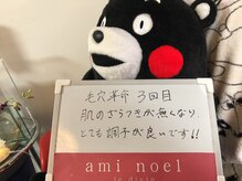 アミノエル/毛穴革命！お客様の声