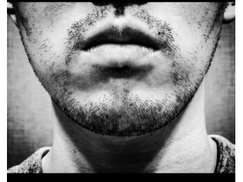 ビーバイビー(BBYB)/【メンズ】顔脱毛!!髭脱毛!!