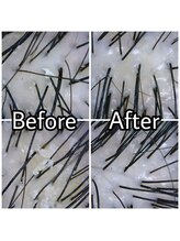 メイリー 上野御徒町店(MEILI)/頭皮スコープ診断でお悩み改善