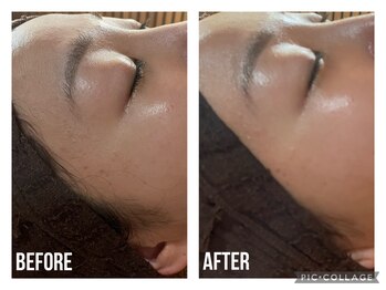 ザ ワン(THE ONE)/たまご肌 ハーブピーリング