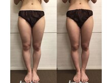 ジュメル 恵比寿店(Jumelles)/太もも周り集中ケア(*^^*)