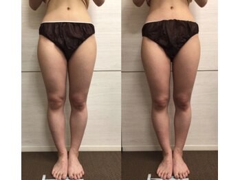 ジュメル 恵比寿店(Jumelles)/太もも周り集中ケア(*^^*)