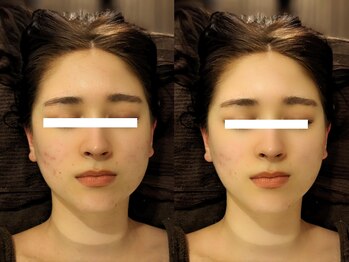 ボディーワークスナビ(Body Works Navi)/美人顔の象徴◆Vフェイスライン