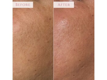 アンドニューリー(&NEWLY)/LDM×クリスティーナ