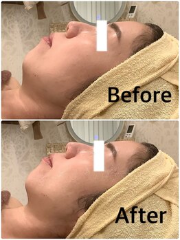 スペチアーレ 夙川/お顔のあらゆるお悩み解決★