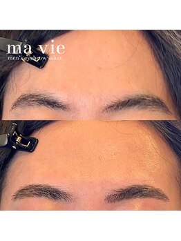 マヴィ 恵比寿 広尾店(ma vie)/ビフォーアフター