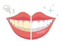 アレッド 大阪店(ared.)/歯が白いと褒められます！