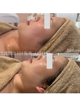 アール(ar.)/シミケアフェイシャル