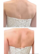 オーシャンスパ(Ocean Spa)/ブライダルエステ