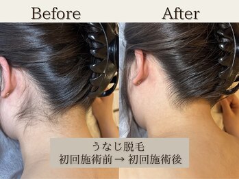 インベスト(INVEST)/Befor After