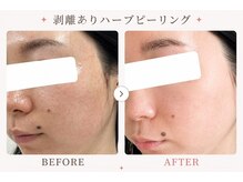 パールプラス 伊勢店(Pearl plus)/複数回重ねる度に艶肌陶器肌へ