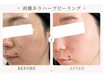 パールプラス 伊勢店(Pearl plus)/複数回重ねる度に艶肌陶器肌へ