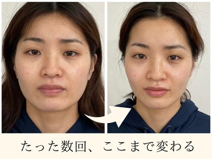 ブランソワンの写真