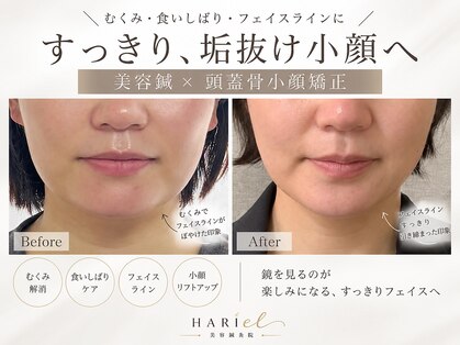 美容鍼灸院ハリエル(HARIel)の写真