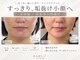 美容鍼灸院ハリエル(HARIel)の写真