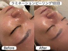 エステサロン アンジュール(Angelle)の雰囲気（全体的にトーンアップと毛穴が小さくなりツヤ感爆発！！）