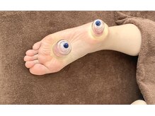 ソレイユ/足裏リリースカッピング