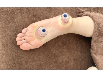 ソレイユ/足裏リリースカッピング