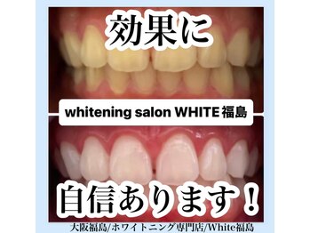 ホワイトニングサロン ホワイト(WHITE)/セルフホワイトニング/大阪/福島