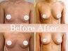 【初回効果実感No.1】結果重視本気の育乳！照射数ＭＡＸ最強ケア