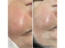 アーチ(AR-CH.)/光フォト