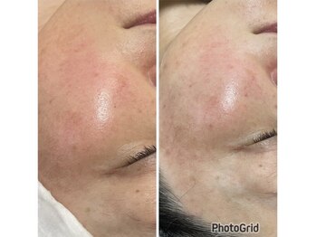 アーチ(AR-CH.)/光フォト