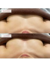 ペキュリア 岡山店(PEQLIA)/バストケア