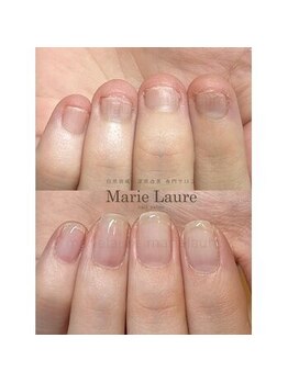 マリーロール 淀屋橋本店(Marie Laure)/深爪矯正/自爪育成/ネイルケア