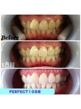 ケーズ(K's)/症例