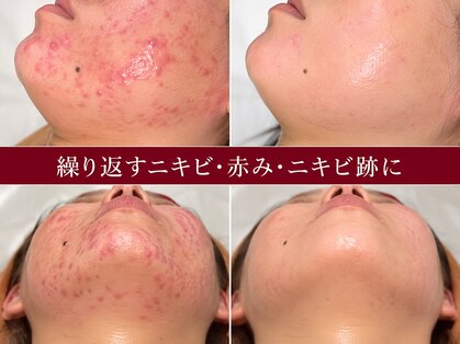ラ ラナン(La lanun)の写真