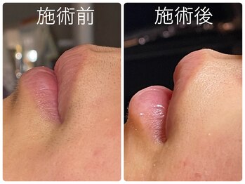 フォーチューン/フェイシャルワックス