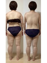 メロス/１ヶ月モニター様結果