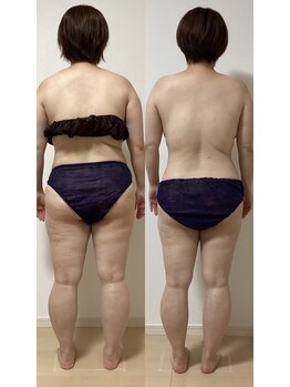 メロス/1ヶ月モニター様結果