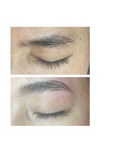 シャンドラ(Shandora)/美容液コース