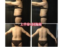 ジャスミン(Jasmine)/背中も変われる！！