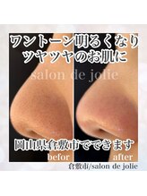 サロンドジョリー/化粧水、美容液の浸透アップ