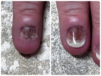 ヴェールリム(verl lim)/