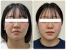 【☆大人気メニュー☆】丸顔・小顔調整×骨盤矯正整体¥9,000⇒¥4,200: