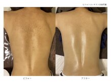 ベルメイク(BELLE MAKE)/水光ピール☆ビフォーアフター