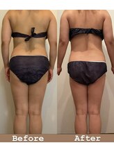 シェリスパ(Cheri Spa)/短期間で4キロ減！