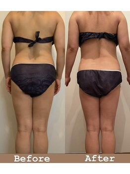 シェリスパ(Cheri Spa)/短期間で4キロ減！