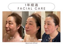 パリワール(pariwar)/インディバ＊メンテナンス